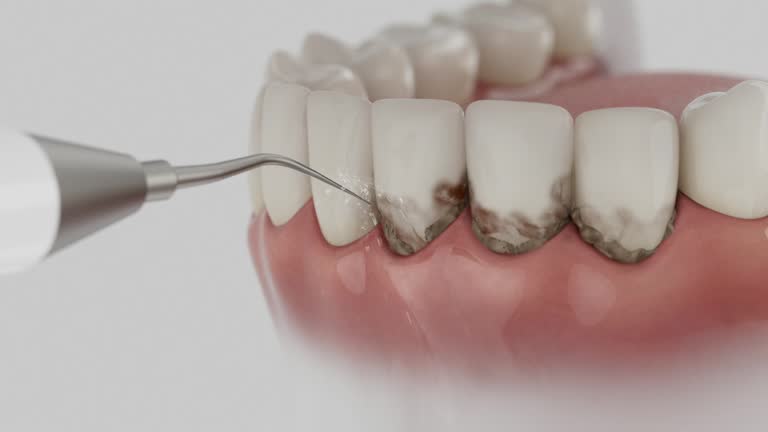 Trusted Teeth Cleaning And Checkup service in Fabrica, TX - Dentist Open Now